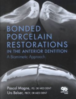 Bonded Porcelain Restorations in the Anterior Dentition A Biomimetic